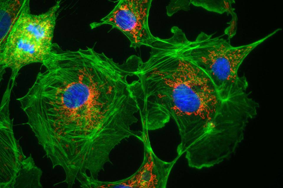 Клетка метка. Цитоскелет конфокальная микроскопия. Цитоскелет клетки флуоресцентная микроскопия. Флуоресцентная и конфокальная микроскопия. Микротрубочки флуоресцентная микроскопия.